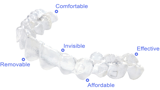 invisible braces diagram