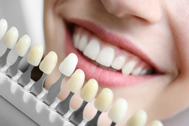 closeup of young woman choosing color of teeth at dentist