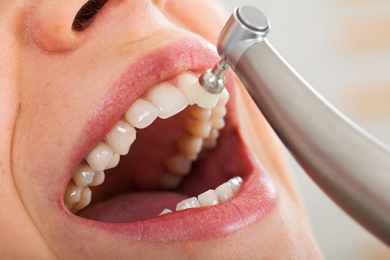 closeup of teeth being cleaned by dental hygienist